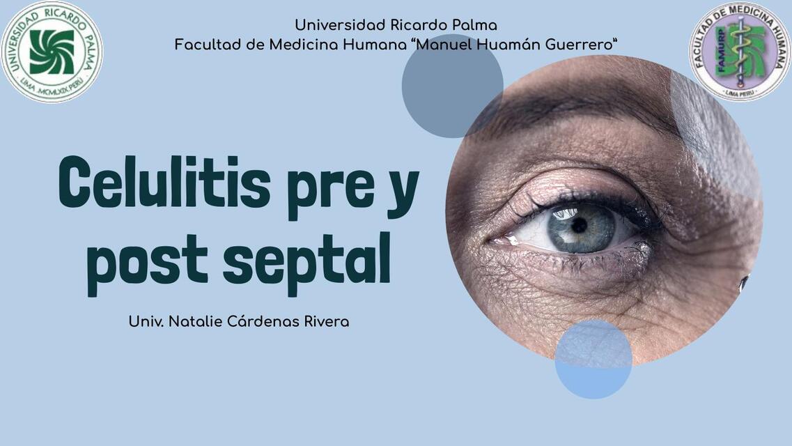 Celulitis pre y post septal