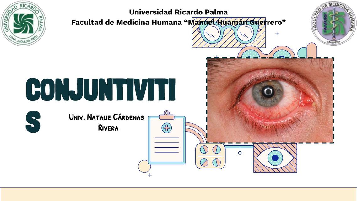 Conjuntivitis