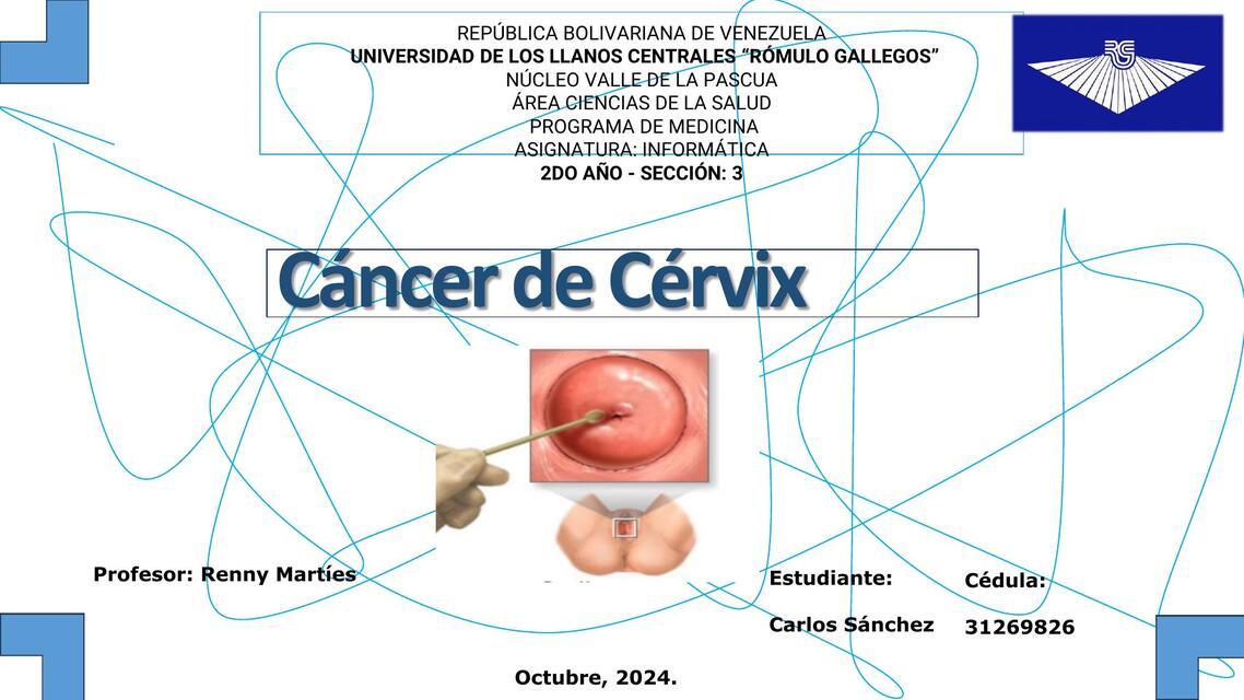 cancer de cervix