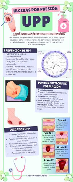 Úlceras por presión UPP
