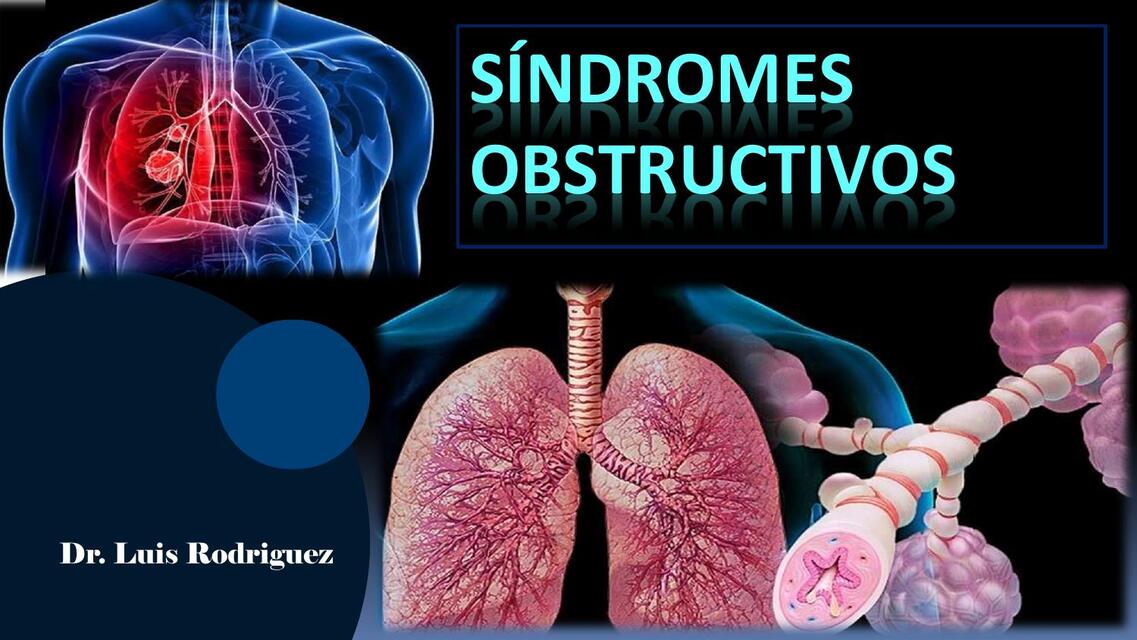 Sindromes Obstructivos