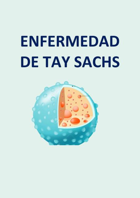 ENFERMEDAD DE TAY SACHS