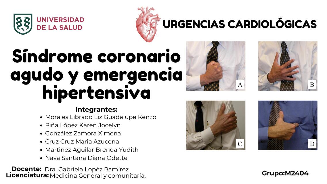 SÍNDROME CORONARIO AGUDO Y EMERGENCIA HIPERTENSIVA