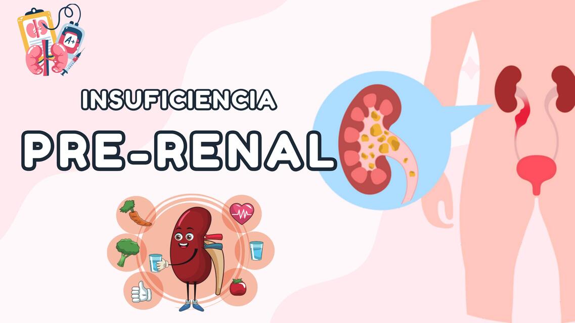 INSUFICIENCIA PRE RENAL