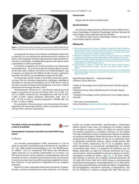 vasculitis paraneo2