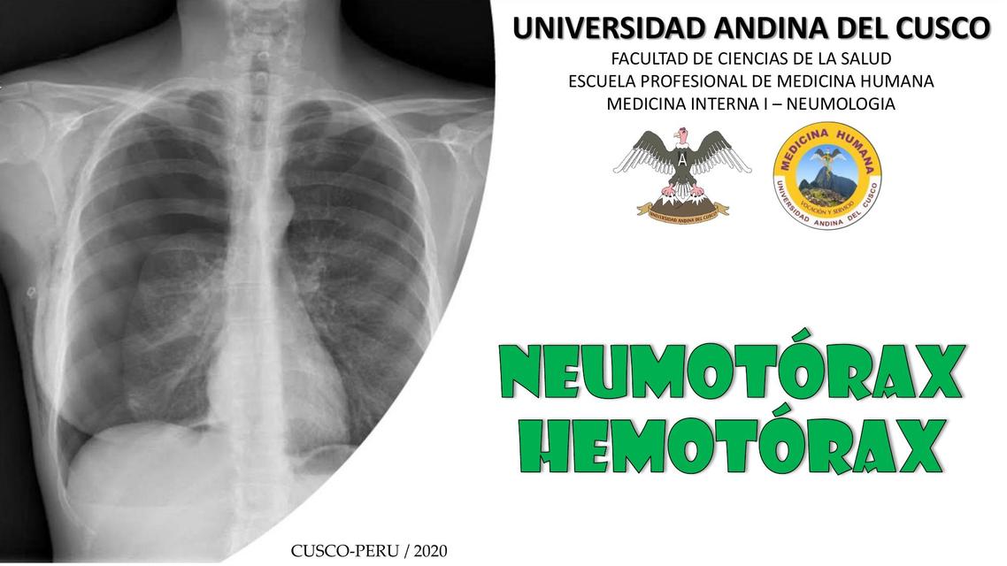 NEUMOTORAX Y HEMOTORAX | Apuntes de medicina | Neumotórax | uDocz