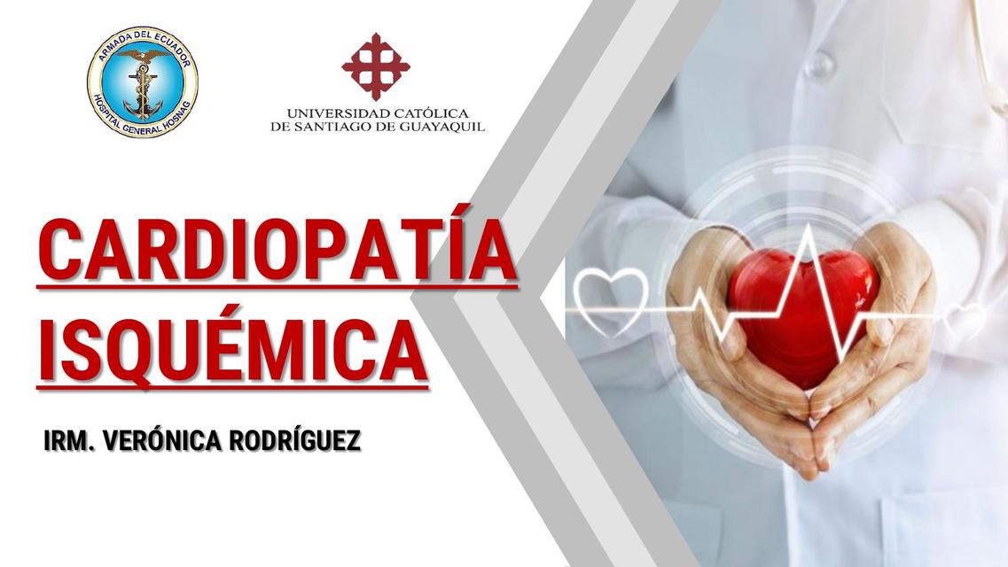 Cardiopatía Isquémica 