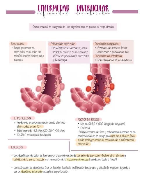 Enfermedad diverticular