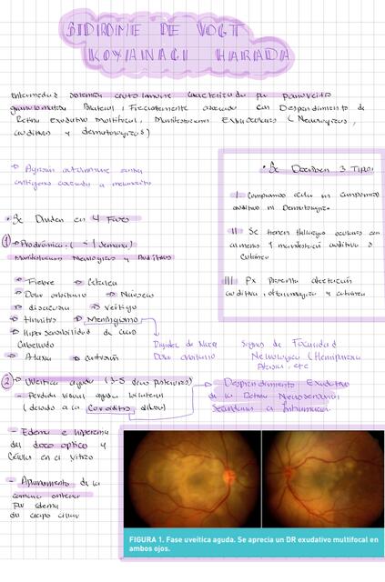 Sx de VKH oftalmologia resumen patología