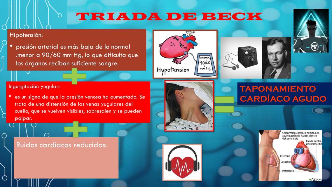 Triada de beck