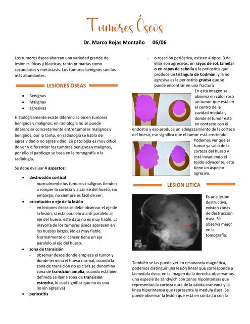 TUMORES OSEOS PARTE 1 RADIOLOGIA TEORICAS UMSS