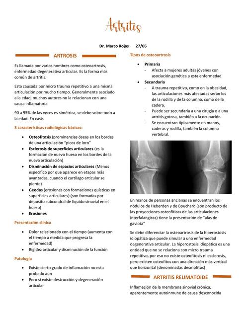 ARTRITIS-ARTROSIS-RADIOLOGIA-UMSS