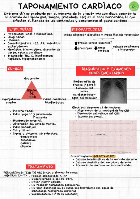 Taponamiento cardiaco