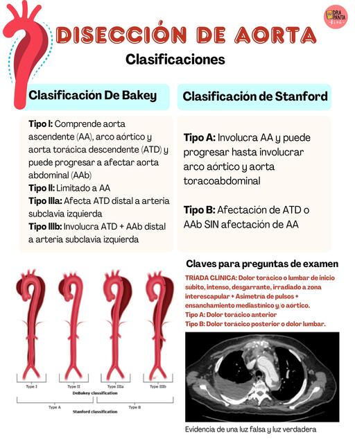 Disección de aorta