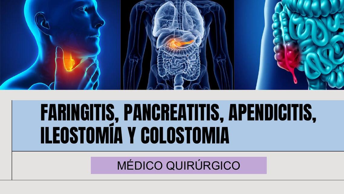 RESUMEN SOBRE FARINGITIS, PANCREATITIS, APENDICITIS, ILEOSTOMÍA Y COLOSTOMÍA