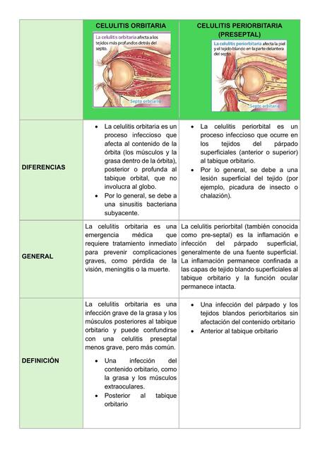 CELULITIS ORBITARIA