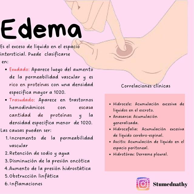 Edema