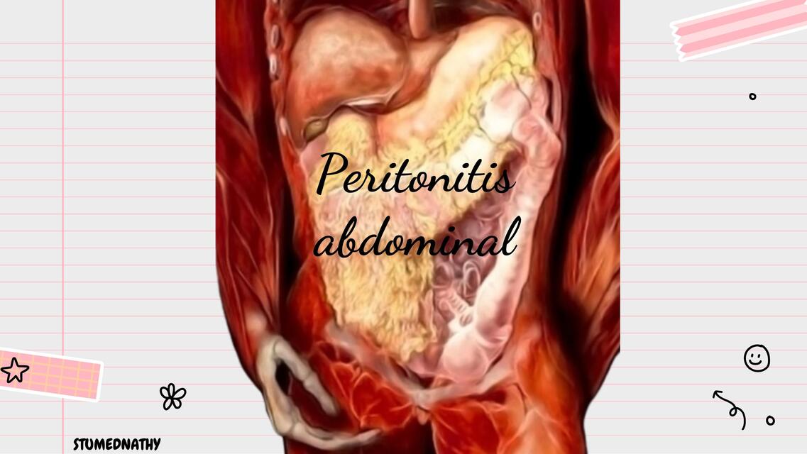 Peritonitis abdominal