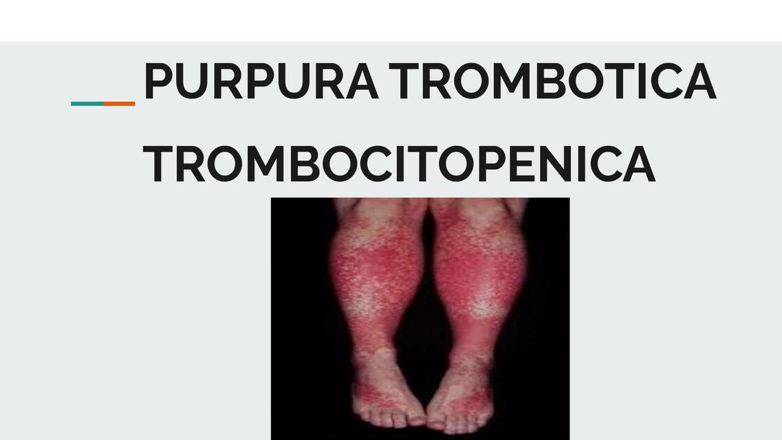 PURPURA TROMBOCITOPENICA 2