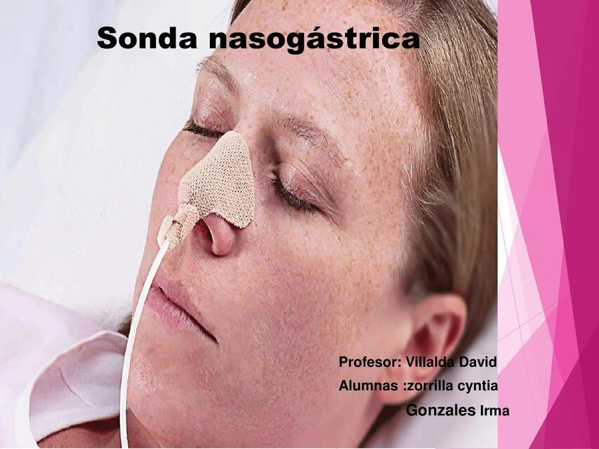 Sonda nasogastrica