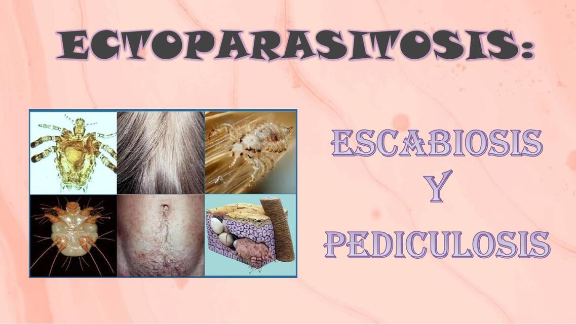 ESCABIOSIS Y PEDICULOSIS