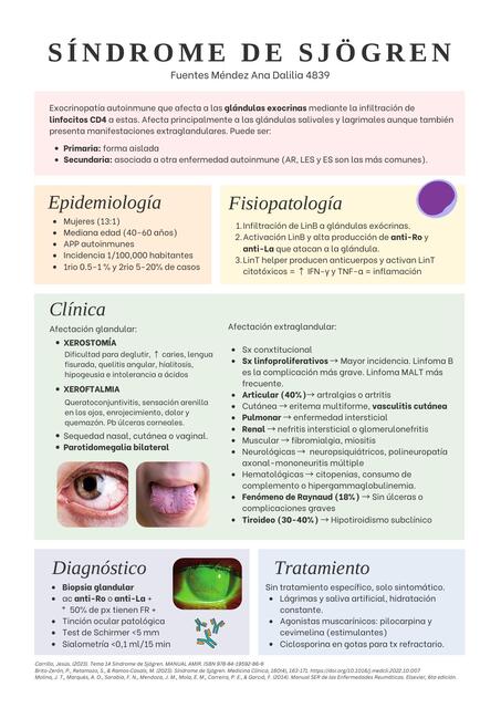 Sx de Sjogren