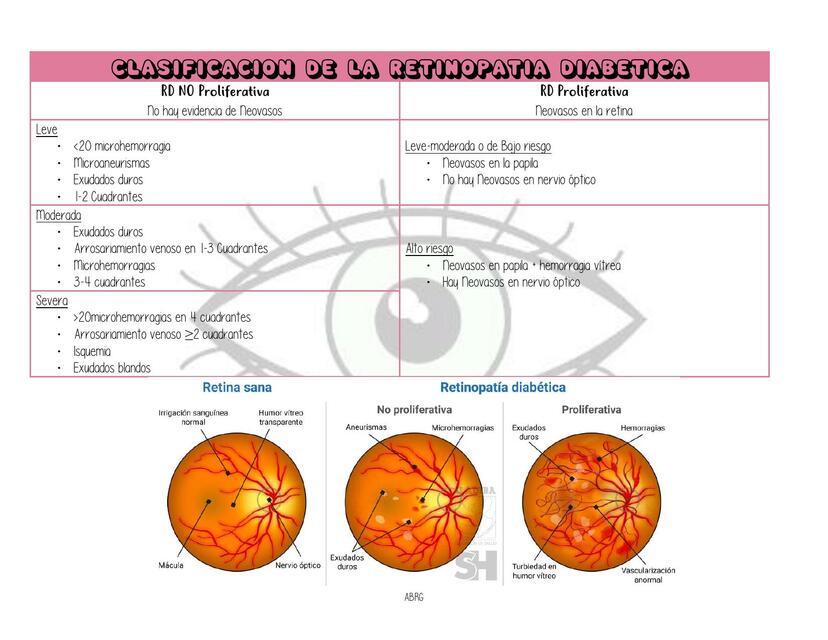 CLASIFICACON DE LA RETINNOPATIA DIABETICA