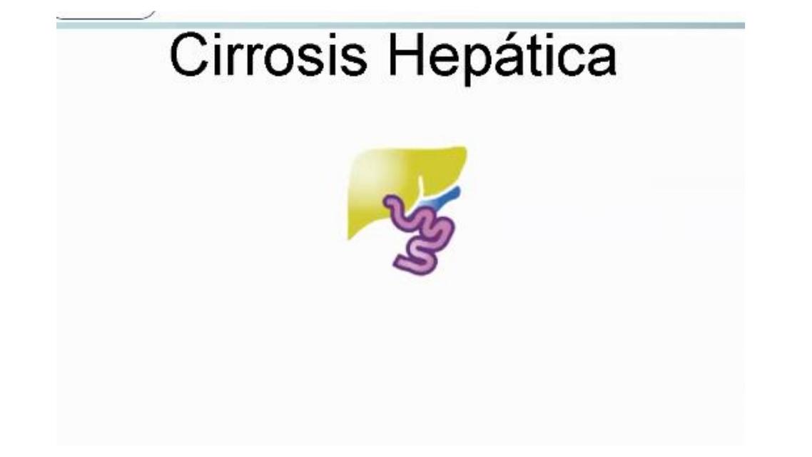 Cirrosis Hepática