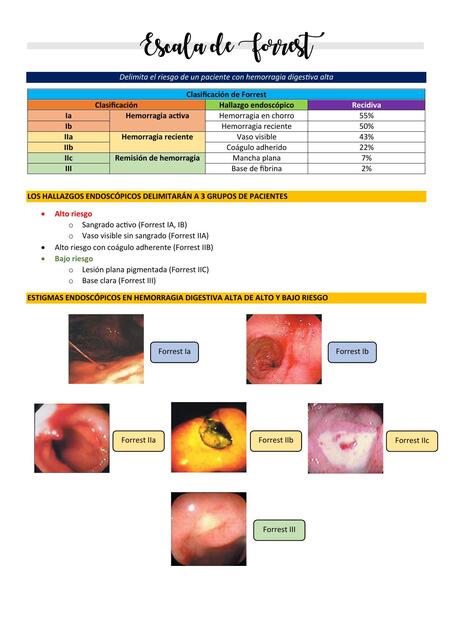Escala de Forrest - Hemorragia digestiva alta