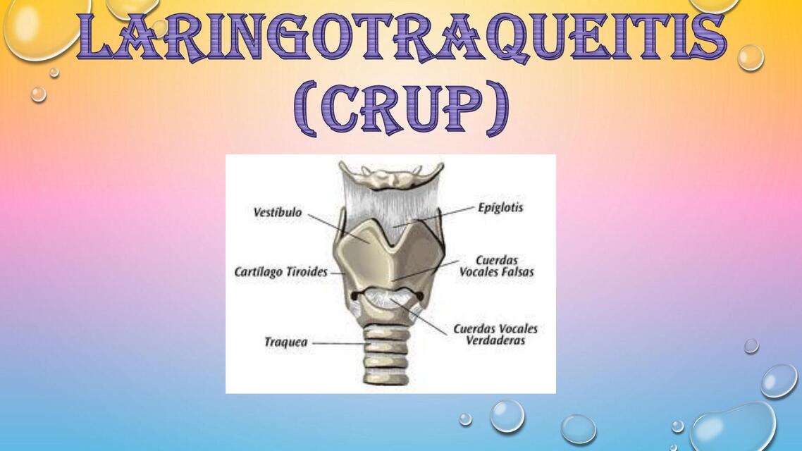 LaringotraqueitiS CRUP