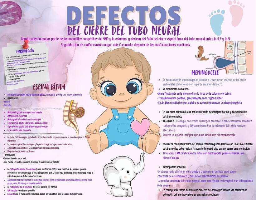 Pediatría: Defectos del cierre del tubo neural