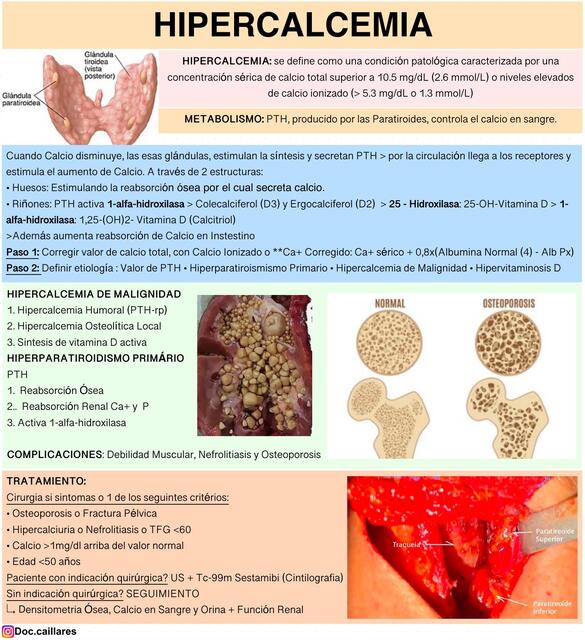 HIPERCALCEMIA