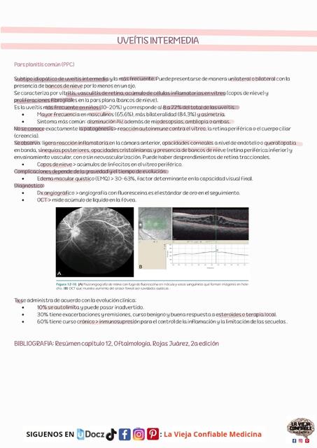 UVEITIS INTERMEDIA