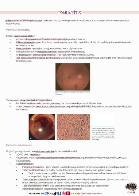 PANUVEITIS