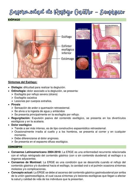 Enfermedad de Reflujo Gastro - Esofágico