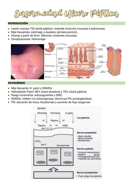 Enfermedad Ulcero Péptica