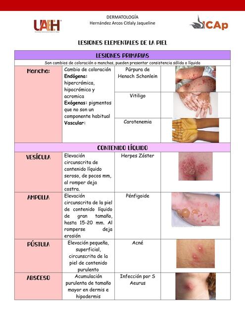 LESIONES ELEMENTALES DE LA PIEL1