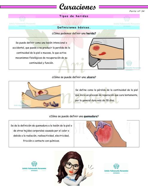 Heridas y curaciones -parte 34 - Tipos de heridas.