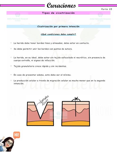 Heridas y curaciones -parte 35 - Tipos de cicatrizacion.