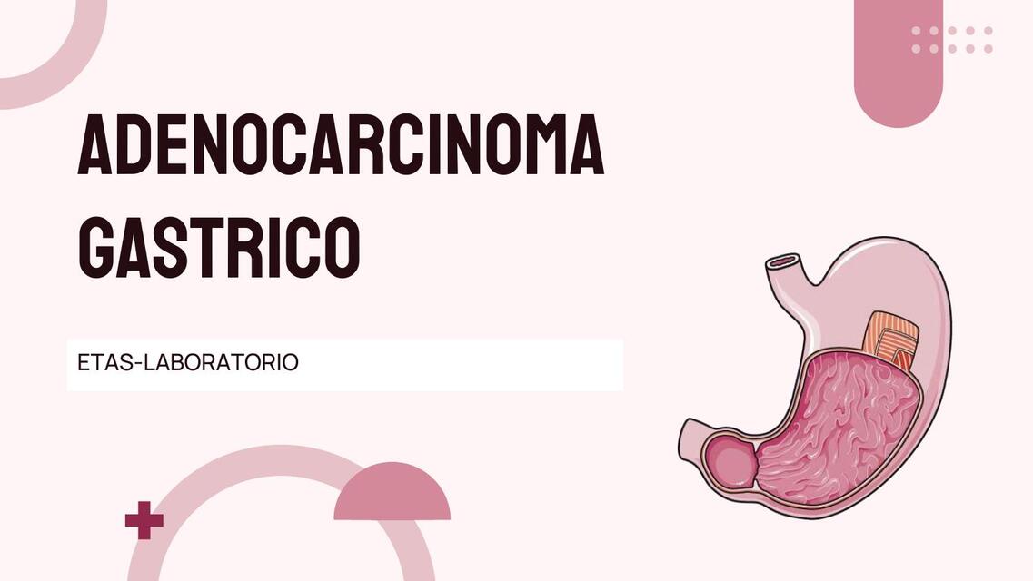 Adenocarcinoma gástrico