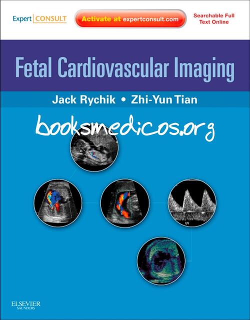 Fetal Cardiovascular Imaging