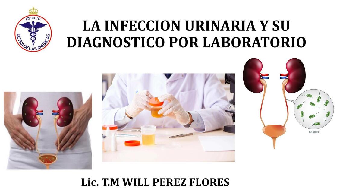 INFECCION URINARIA Y SU DIAGNOSTICO POR LABORATORI