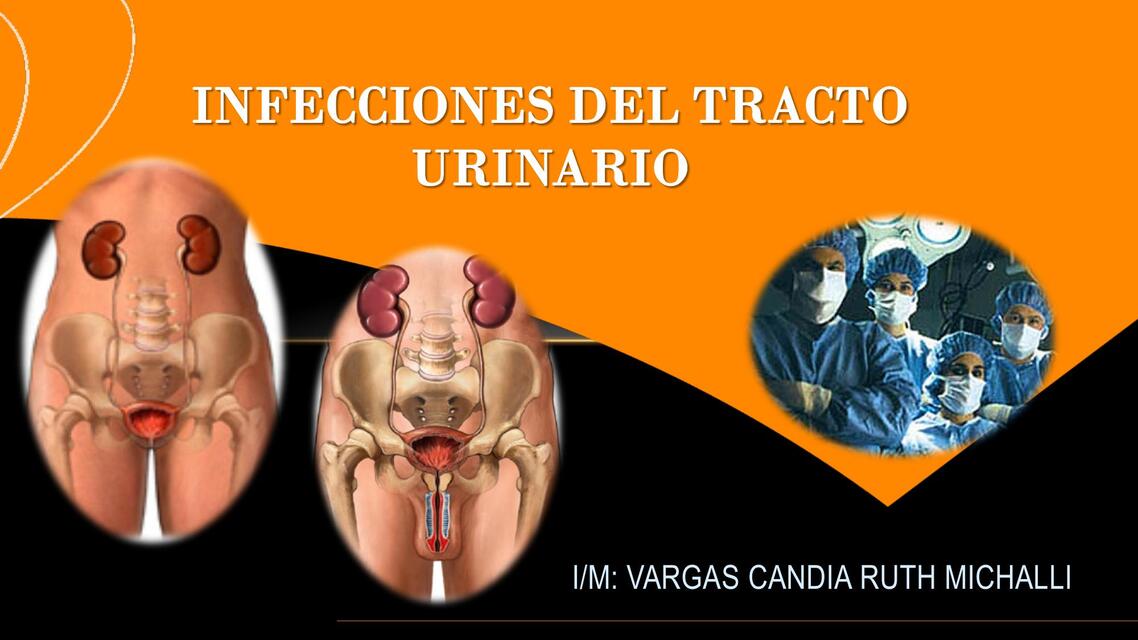 INFECCIONES DEL TRACTO URINARIO