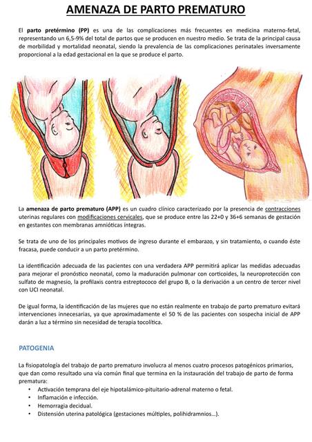 AMENAZA DE PARTO PREMATURO