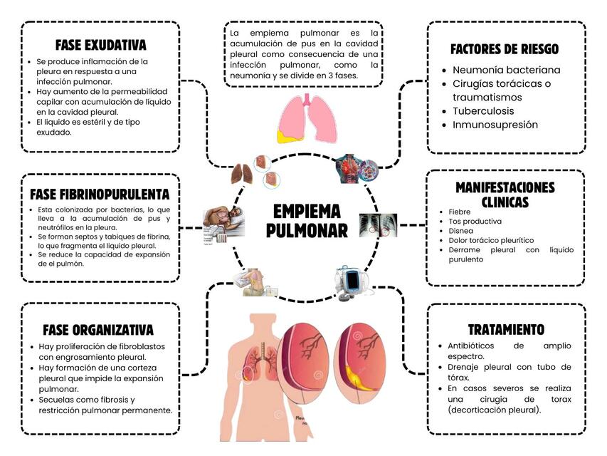 EMPIEMA PULMONAR