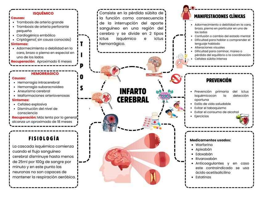 INFARTO CEREBRAL