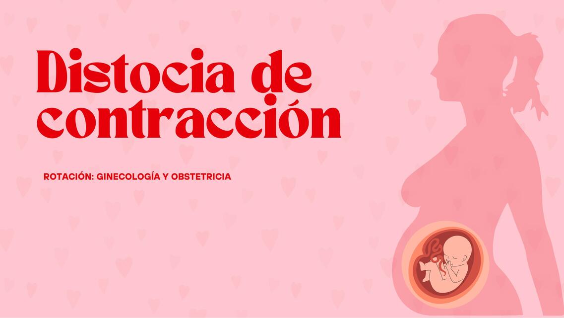 Distocia de contracción