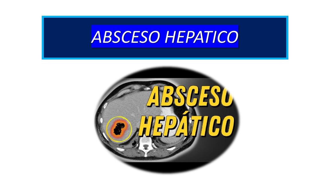 ABSCESO HEPÁTICO