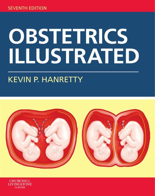 Obstetrics illustrated Churchill Hanretty 7 Editic