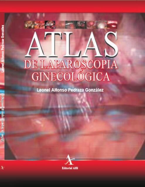 Atlas de Laparoscopía Ginecologíca 1 Edición